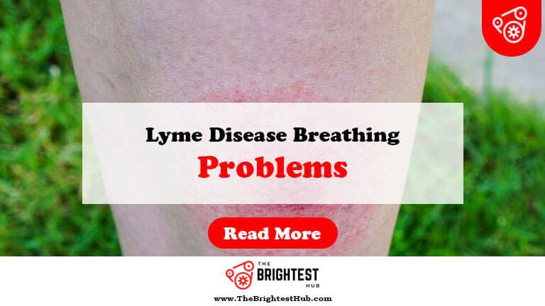 Lyme-Disease-Breathing-Problems-Fi1